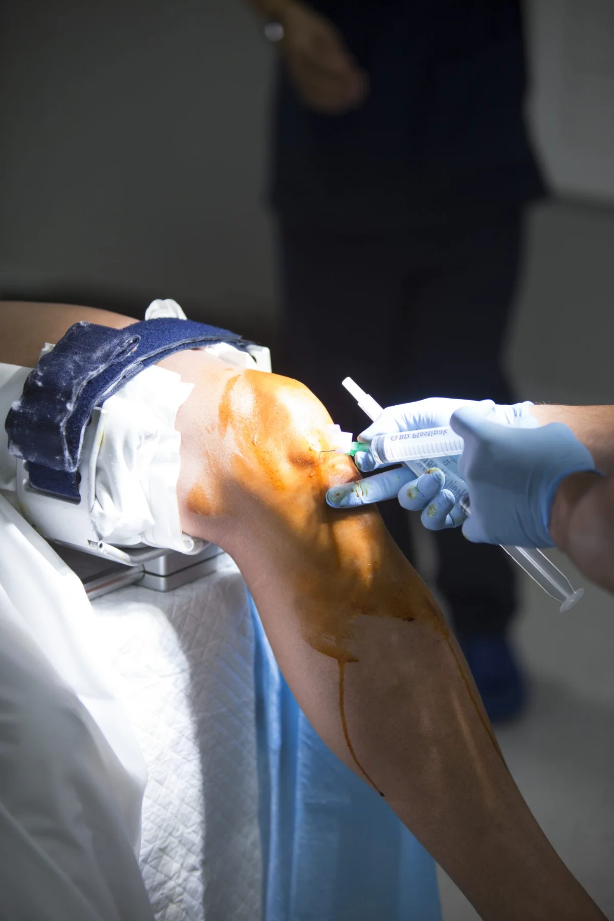 Arthroscopy & Sports Injuries